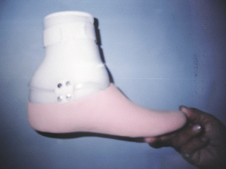 Se muestra las caracteristicas de la ortopr�tesis confeccionada en polipropileno.