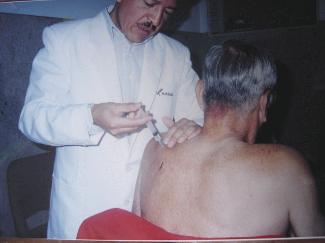 Procedimiento: Bloqueo supraescapular en paciente portador de Sindrome hombro-mano (DSR)