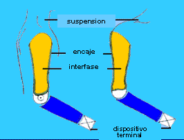 Prótesis Desarticulado de Codo